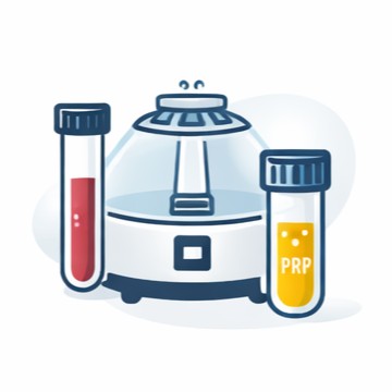 Terapi nyeri sendi Kediri terapi regeneratif prp